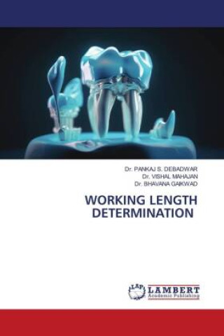 Knjiga WORKING LENGTH DETERMINATION Vishal Mahajan
