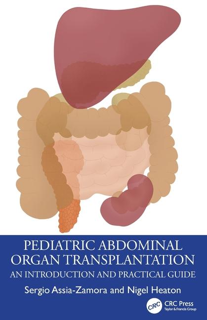 Książka Pediatric Abdominal Organ Transplantation Sergio (King's College Hospital) Assia-Zamora