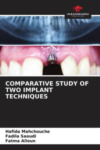Knjiga COMPARATIVE STUDY OF TWO IMPLANT TECHNIQUES Fadila Saoudi