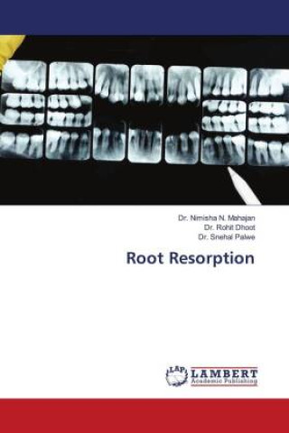 Knjiga Root Resorption Rohit Dhoot