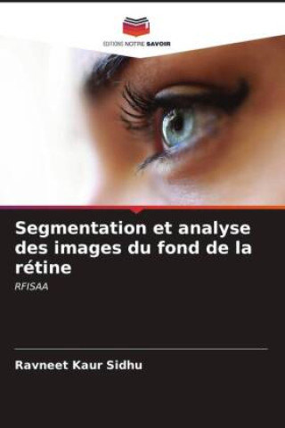 Kniha Segmentation et analyse des images du fond de la rétine 