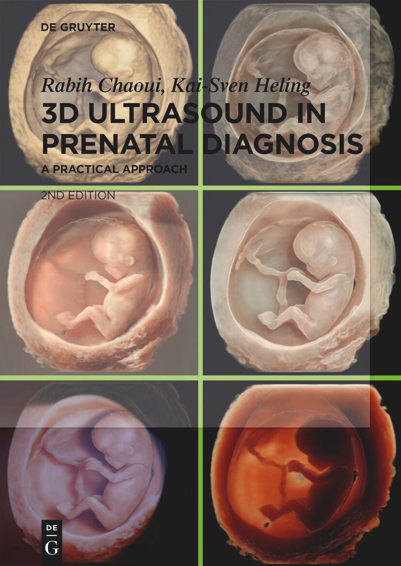 Kniha 3D Ultrasound in Prenatal Diagnosis Kai-Sven Heling
