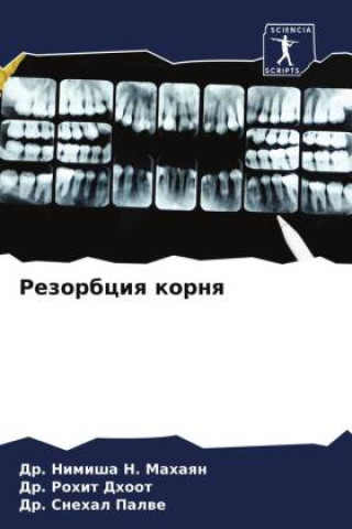 Boek Rezorbciq kornq Rohit Dhoot