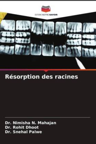 Knjiga Résorption des racines Dr. Nimisha N. Mahajan