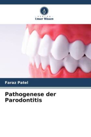 Knjiga Pathogenese der Parodontitis Faraz Patel