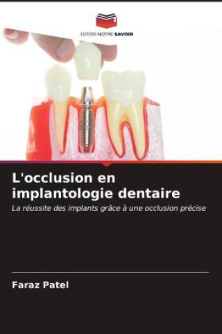 Knjiga L'occlusion en implantologie dentaire Faraz Patel