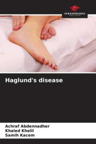Knjiga Haglund's disease Khaled Khelil