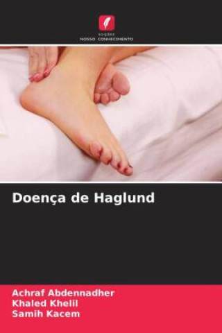 Knjiga Doença de Haglund Khaled Khelil