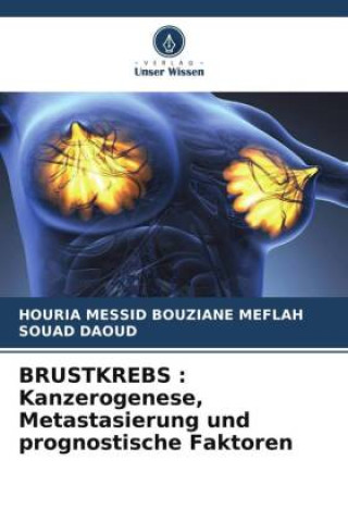 Könyv BRUSTKREBS : Kanzerogenese, Metastasierung und prognostische Faktoren Souad Daoud