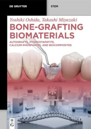 Carte Bone-Grafting Biomaterials Yoshiki Oshida