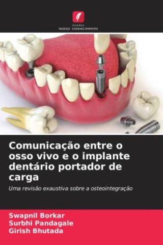 Carte Comunicaç?o entre o osso vivo e o implante dentário portador de carga Surbhi Pandagale