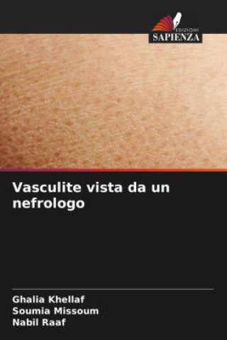 Knjiga Vasculite vista da un nefrologo Soumia Missoum