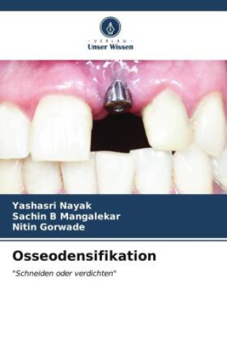Kniha Osseodensifikation Yashasri Nayak