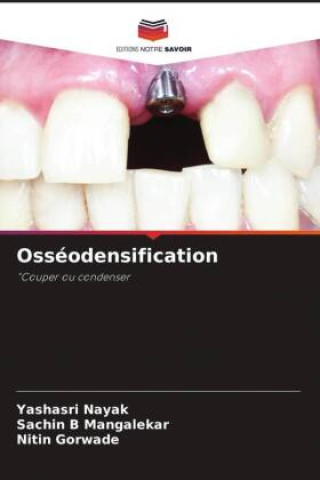 Kniha Osséodensification Yashasri Nayak