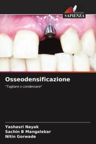 Libro Osseodensificazione Yashasri Nayak