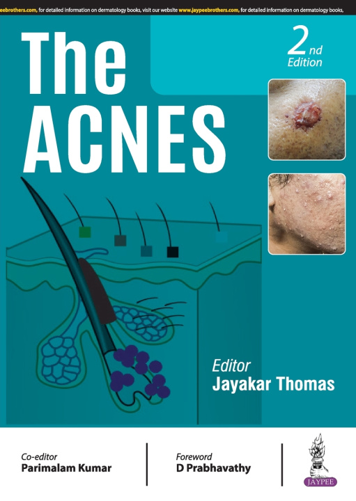 Knjiga Acnes Jayakar Thomas