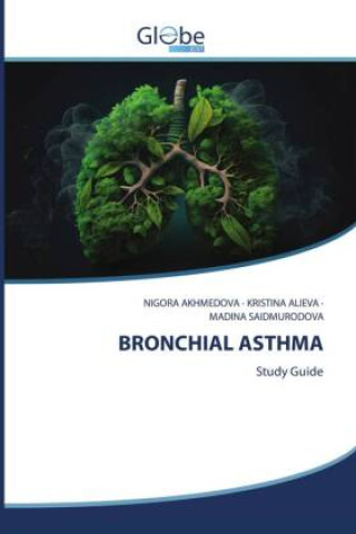 Kniha BRONCHIAL ASTHMA Kristina Alieva