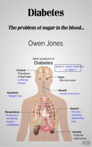 Knjiga Diabetes Owen Jones