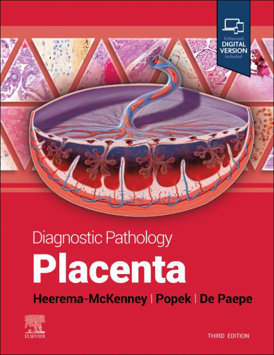 Książka Diagnostic Pathology: Placenta Amy Heerema-McKenney