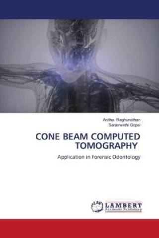 Kniha CONE BEAM COMPUTED TOMOGRAPHY Saraswathi Gopal