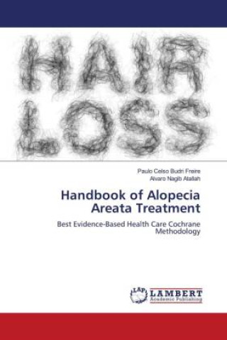 Kniha Handbook of Alopecia Areata Treatment Paulo Celso Budri Freire