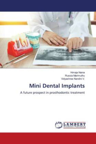 Carte Mini Dental Implants Russia Marimuthu