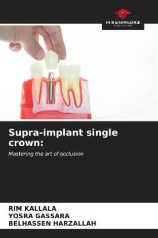 Boek Supra-implant single crown: Yosra Gassara