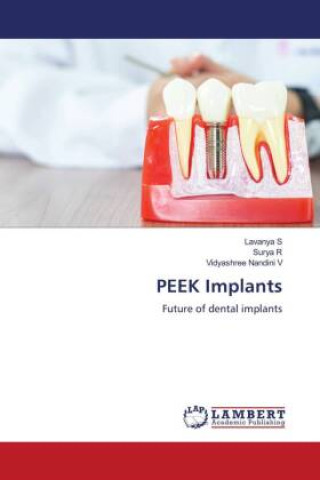 Knjiga PEEK Implants Surya R