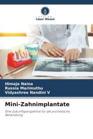 Buch Mini-Zahnimplantate Himaja Naina