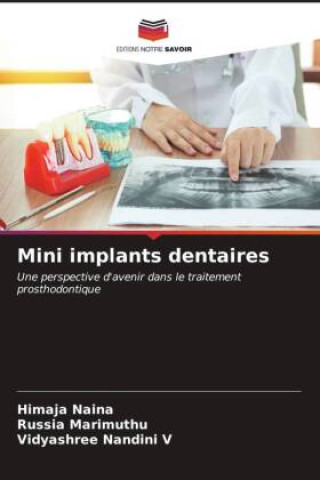 Knjiga Mini implants dentaires Himaja Naina