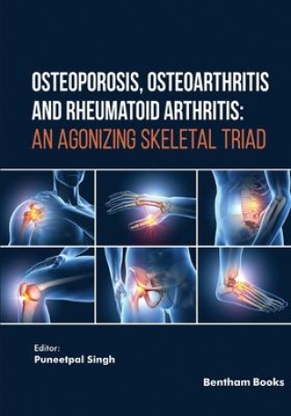Книга Osteoporosis, Osteoarthritis and Rheumatoid Arthritis 