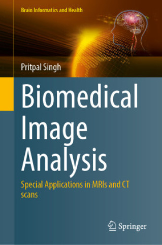 Book Biomedical Image Analysis Pritpal Singh