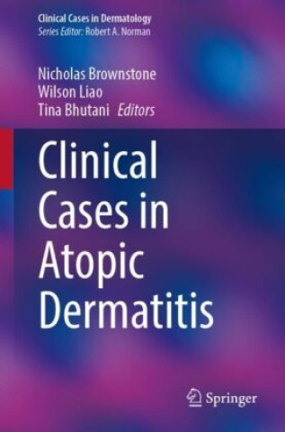 Buch Clinical Cases in Atopic Dermatitis Nicholas Brownstone