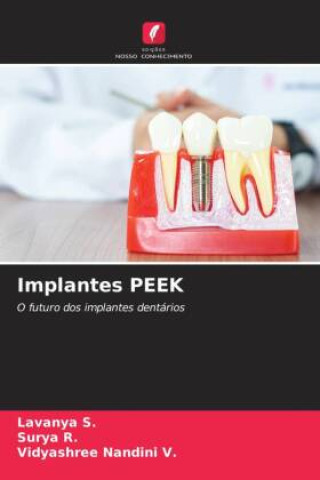 Carte Implantes PEEK Surya R.