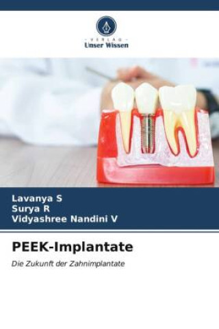 Книга PEEK-Implantate Surya R