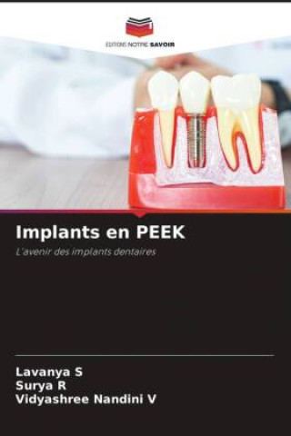 Knjiga Implants en PEEK Surya R