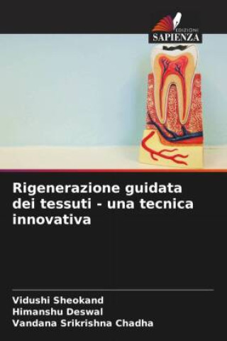 Buch Rigenerazione guidata dei tessuti - una tecnica innovativa Himanshu Deswal
