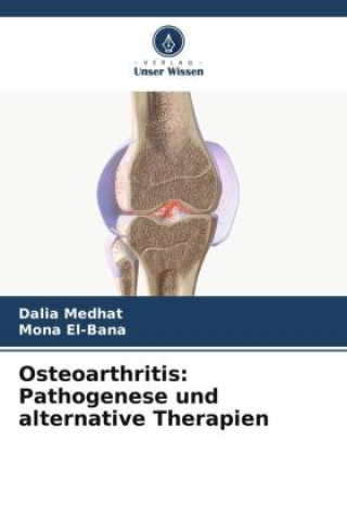 Carte Osteoarthritis: Pathogenese und alternative Therapien Mona El-Bana