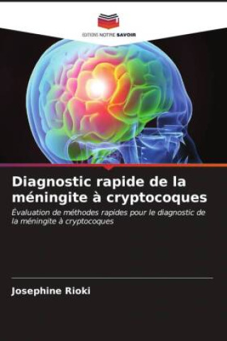 Книга Diagnostic rapide de la méningite à cryptocoques Josephine Rioki