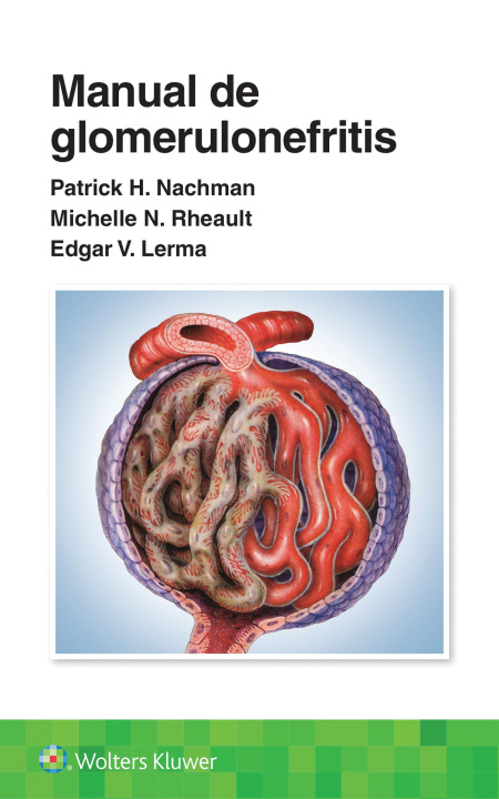 Carte Manual de glomerulonefritis Patrick Henry Nachman