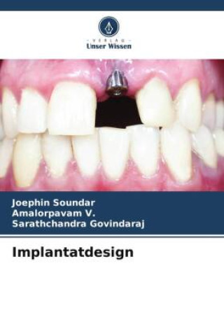Buch Implantatdesign Amalorpavam V.