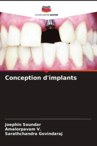 Knjiga Conception d'implants Amalorpavam V.