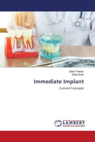 Knjiga Immediate Implant Shilpi Shah