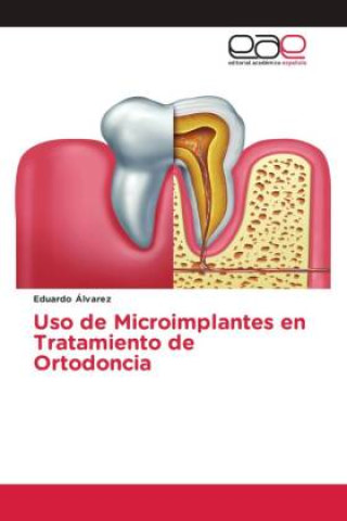 Carte Uso de Microimplantes en Tratamiento de Ortodoncia Eduardo Álvarez