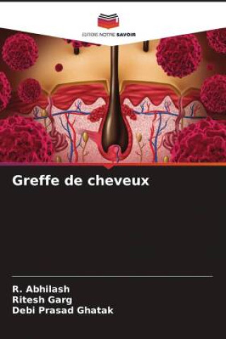 Knjiga Greffe de cheveux Ritesh Garg