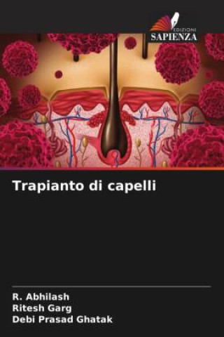 Buch Trapianto di capelli Ritesh Garg