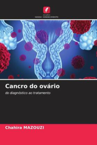Knjiga Cancro do ovário Chahira MAZOUZI