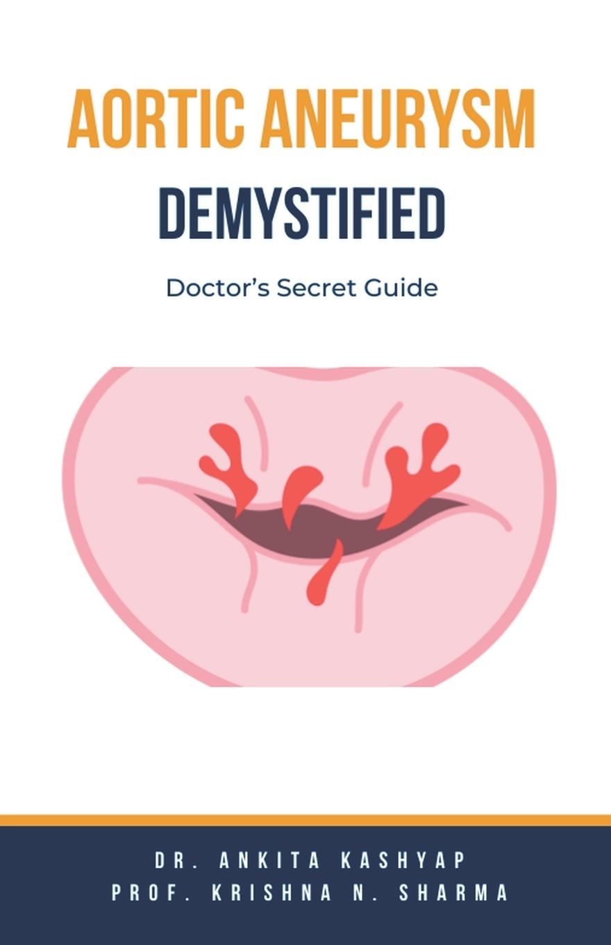 Knjiga Aortic Aneurysm Demystified Krishna N. Sharma