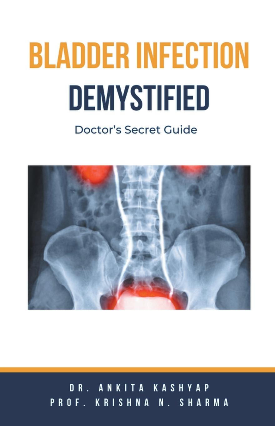 Knjiga Bladder Infection Demystified Krishna N. Sharma