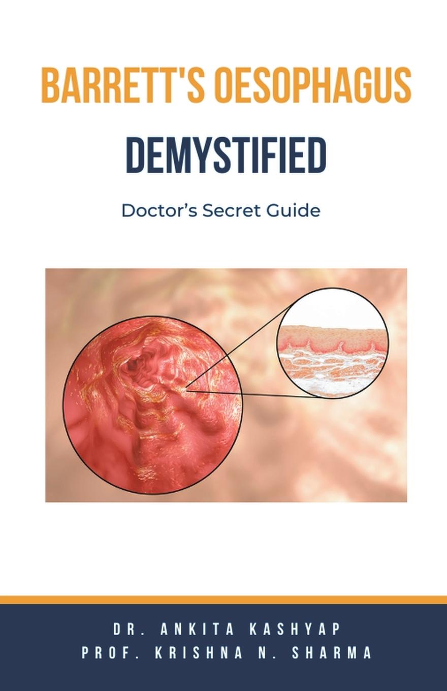 Knjiga Barretts Oesophagus Demystified Krishna N. Sharma